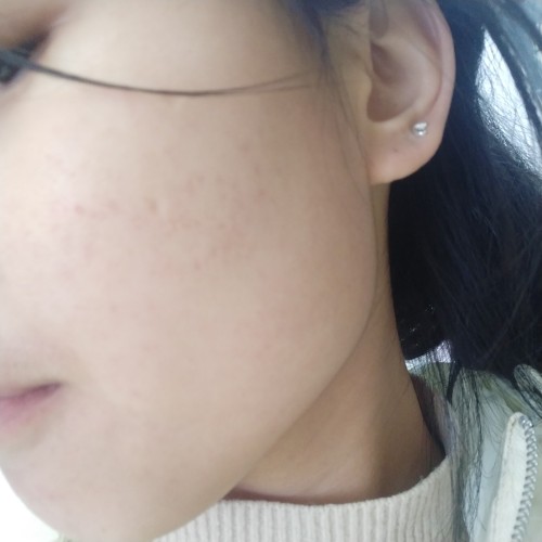 益膚醫(yī)用冷敷貼面膜怎么樣好不好，真實使用體驗(敏感肌必備)