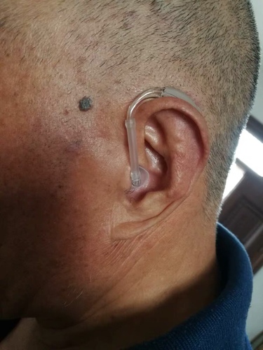 瑞聲達(dá)助聽(tīng)器質(zhì)量怎么樣是哪個(gè)國(guó)家的好嗎，用戶評(píng)測(cè)(價(jià)格399元)