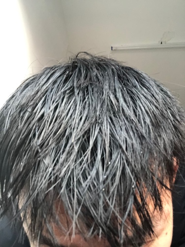 有情生姜洗發(fā)水是真的好有效嗎多少錢，防脫發(fā)效果親測(僅19.9元)